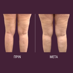 vp-website-before-after-1200x1200-03