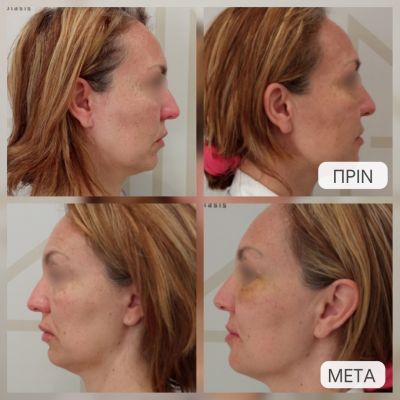 photo gallery before   after